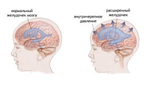 Запаморочення та аритмія