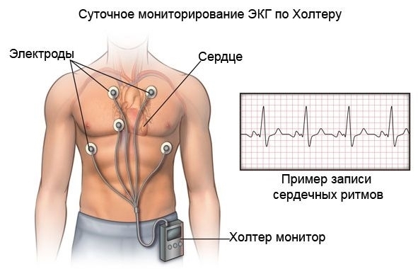 Нічна аритмія